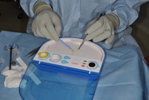 The Burn Center participated in the clinical trials of ReCell, a technology that deconstructs a small biopsy of a patient’s skin and dilutes it in a solution that can then be sprayed onto a wound. From there, the patient’s skin cells will populate the wound and regrow skin. (U.S. Army photo)