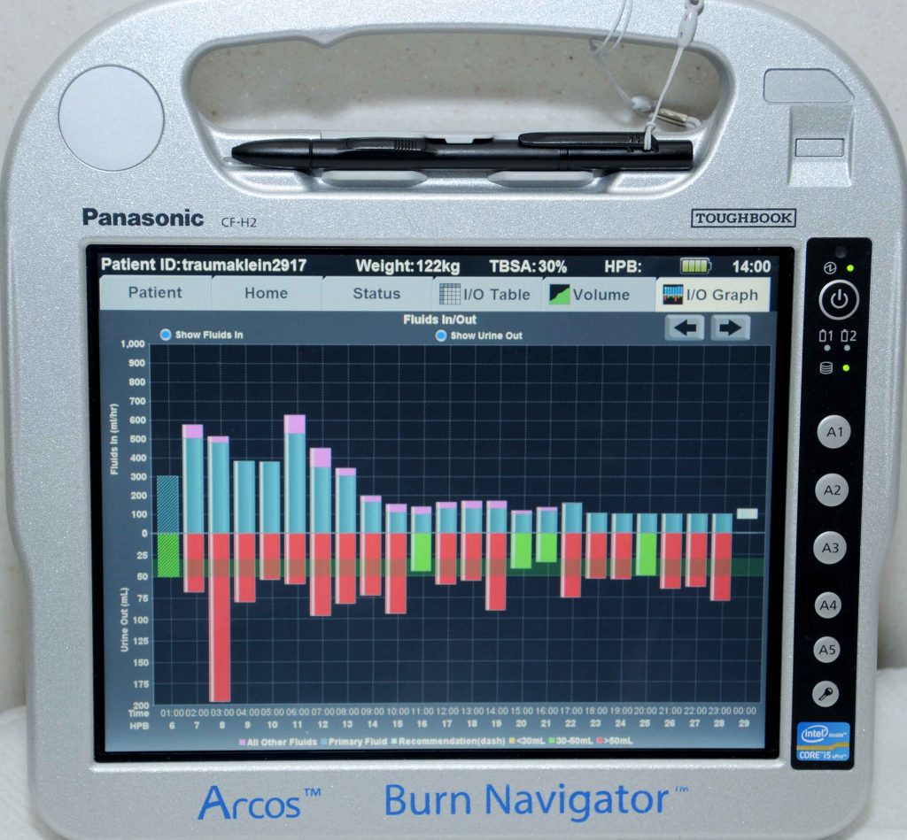 To avoid giving burn patients too much intravenous fluid, which can create swelling that can cause life- or limb-threatening complications, the Burn Center developed Burn Navigator, manufactured by Arcos Medical Inc. The bedside computer helps guide resuscitation in burn patients. (U.S. Army photo)